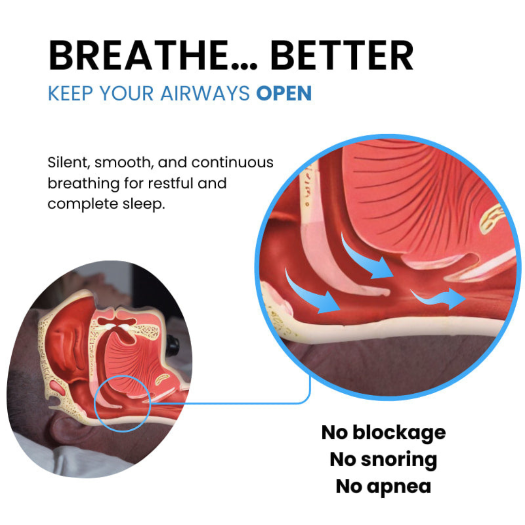 Zynura EMS Anti-Snoring Device