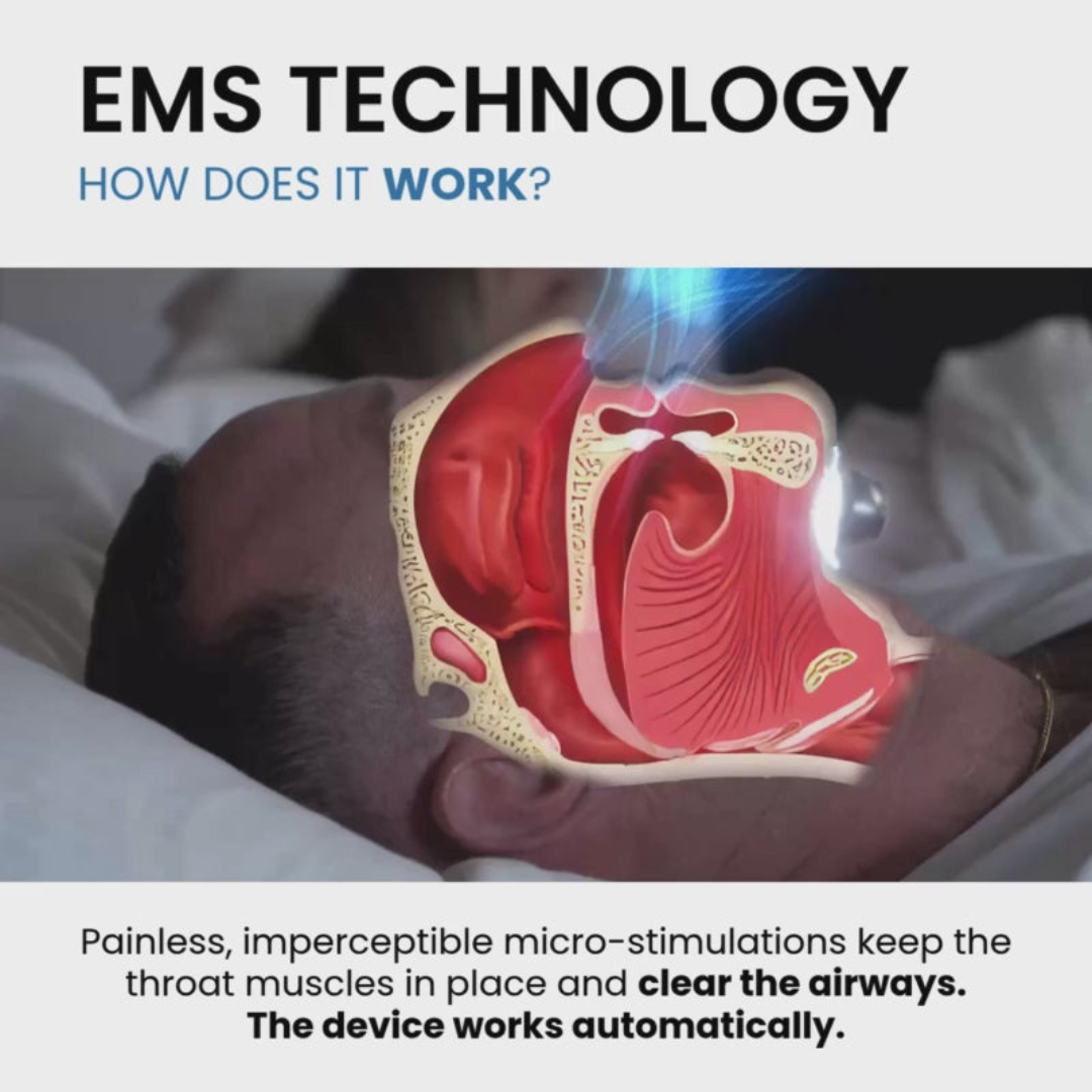 Zynura EMS Anti-Snoring Device